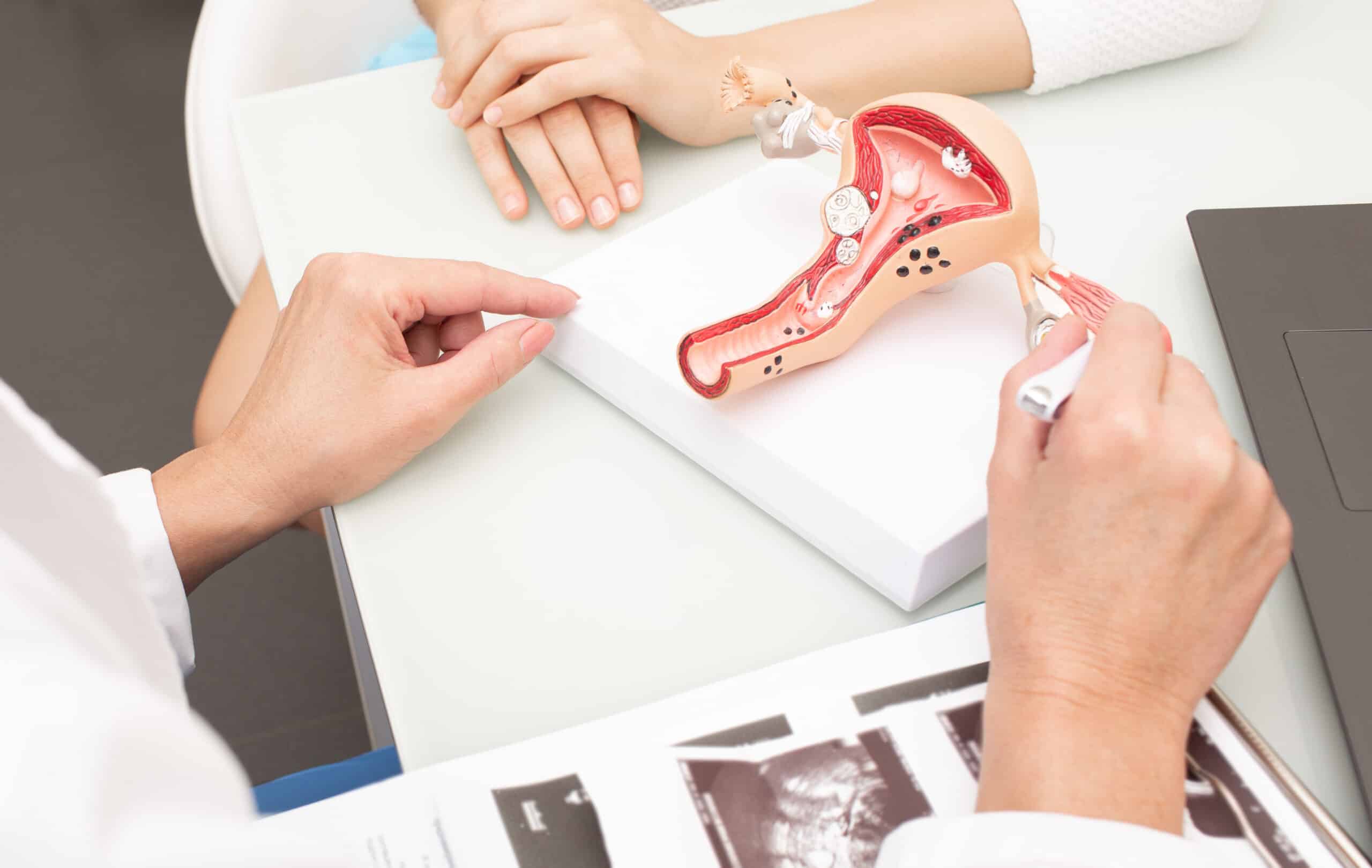 Gynecology, women's health. Close-up of a uterus model